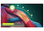 do 3d medical device animation 3d surgery animation 3d medical explainer video